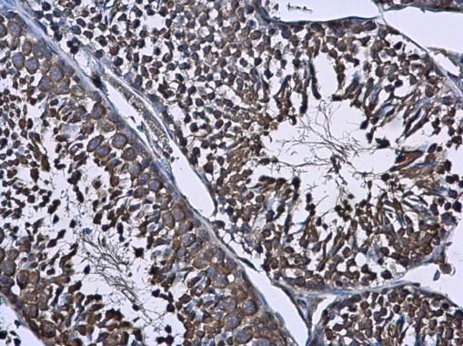 Wilms Tumor 1 antibody