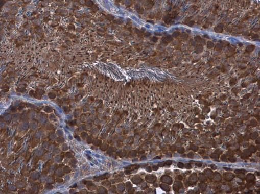 Wilms Tumor 1 antibody