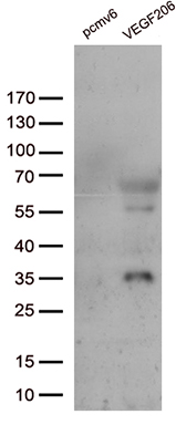 Wilms Tumor Protein Antibody