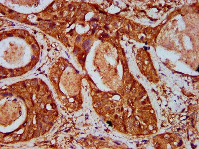 WIPF2 Antibody