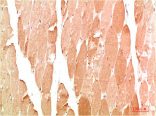 WIPI2 Antibody