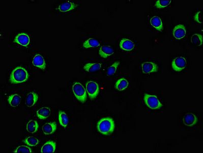 WISP1 antibody