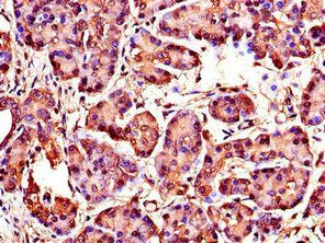 WISP1 antibody