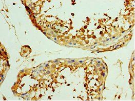 WISP2 antibody