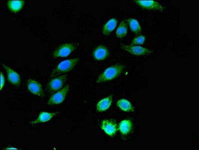WNK1 Antibody
