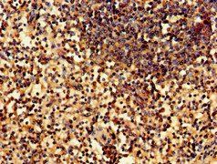 WNK1 Antibody