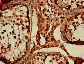 WNK1 Antibody