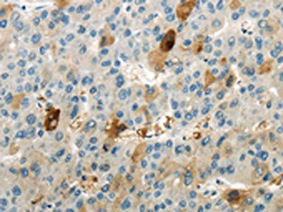 WNK1 Antibody