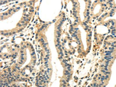 WNK2 Antibody