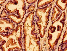 WNK2 Antibody
