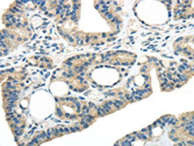 WNK3 Antibody