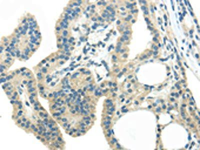 WNK3 Antibody