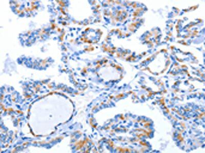 WNT1 Antibody
