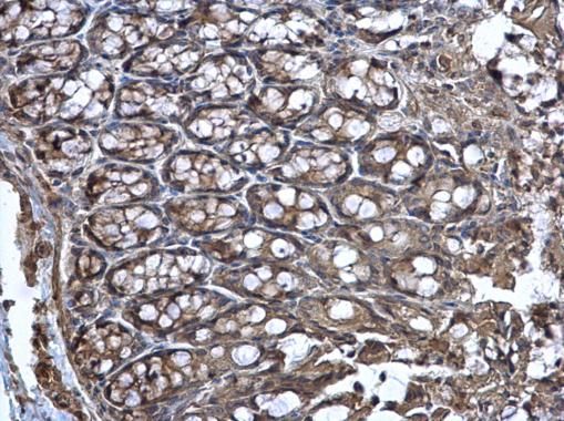 Wnt11 antibody