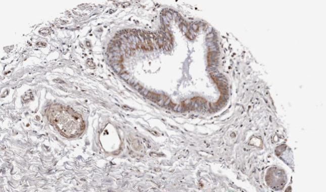 Wnt family member 11 Antibody