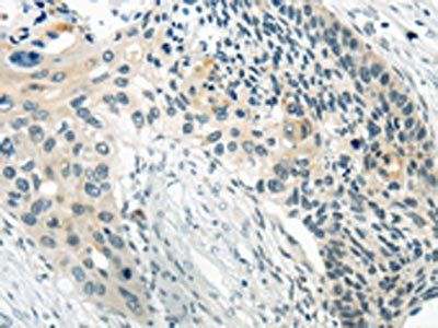 WNT2B Antibody
