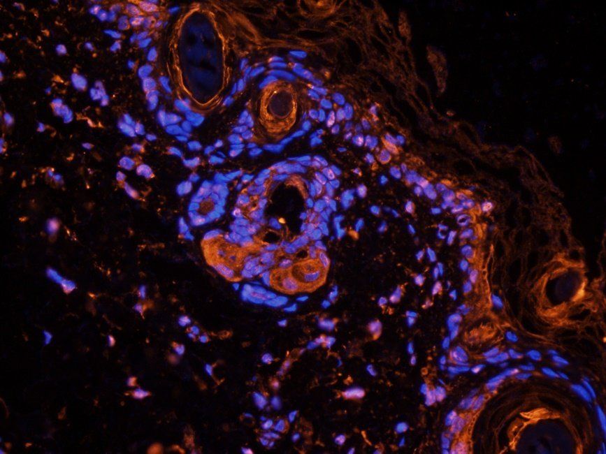 WNT3 antibody