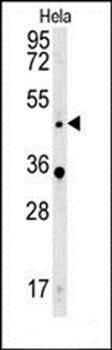 WNT5A antibody