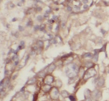 WNT5A-B antibody