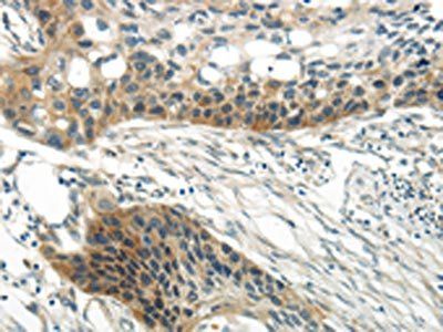 WNT6 Antibody