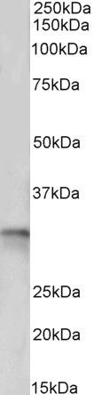 Goat anti-tropomyosin 4 / TPM4 Antibody