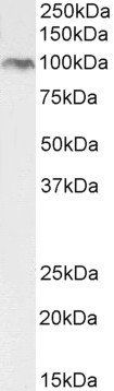 BMP1 antibody