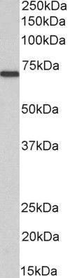 Goat anti-MTM1 Antibody