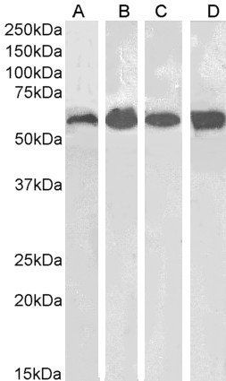 Goat anti-Catalase / CAT Antibody
