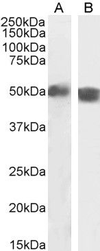 Goat anti-Carabin / TBC1D10C Antibody