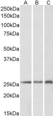 CSRP2 antibody