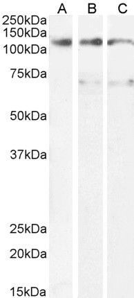 Goat anti-OSMR Antibody