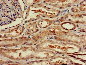 WSB1 Antibody