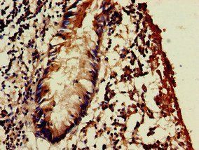 WSB1 Antibody
