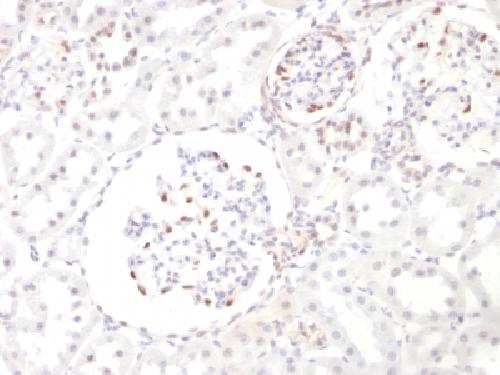 Wilm’s Tumor 1 (WT1) (Wilm’s Tumor & Mesothelial Marker) Antibody