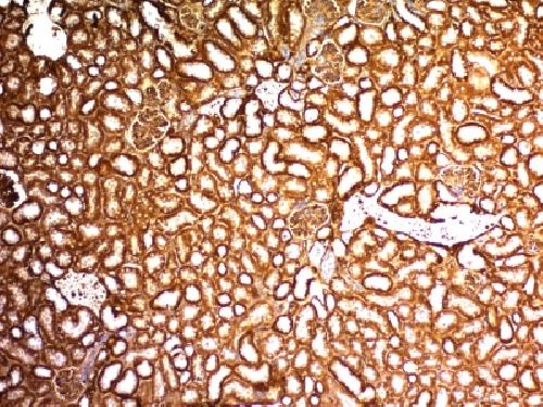 Wilm’s Tumor 1 (WT1) (Wilm’s Tumor & Mesothelial Marker) Antibody