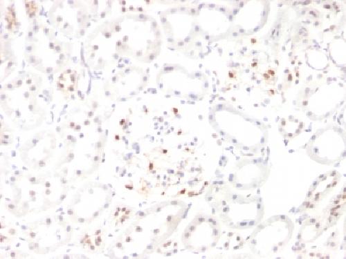 Wilm’s Tumor 1 (WT1) (Wilm’s Tumor & Mesothelial Marker) Antibody