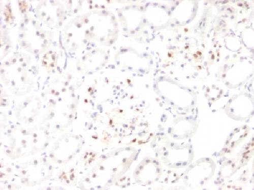 WT1 antibody