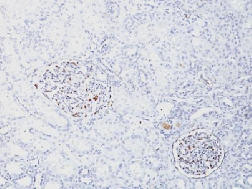 Recombinant Wilm's Tumor 1 (WT1) (Wilm's Tumor & Mesothelial Marker) Antibody