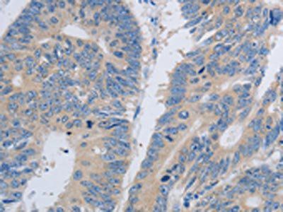 PAWR Antibody