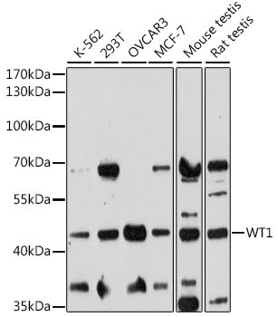 WT1 antibody