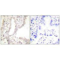 WT1 antibody