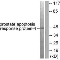 WT1 antibody