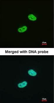 WT1 antibody