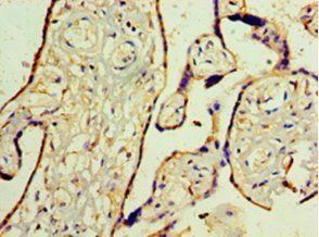 WT1 Antibody