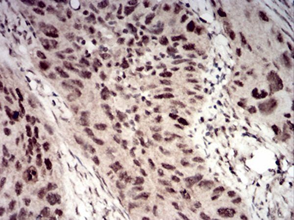 WTAP Antibody