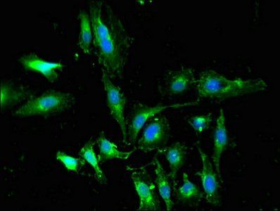 WTAP Antibody