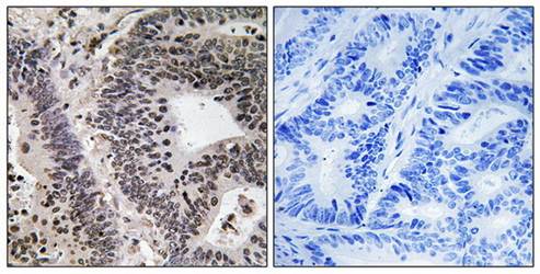 WWOX (Phospho-Tyr33) Antibody