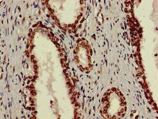 X-ray repair cross-complementing protein 6 antibody