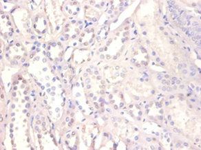 XRCC6 Antibody