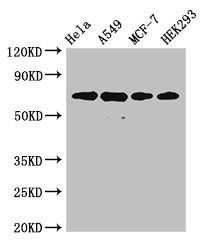 X-ray repair cross-complementing protein 6 antibody